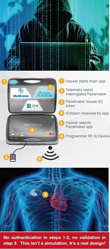 Steps to Hack a Pacemaker